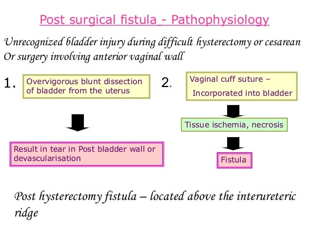 tear of vaginal fistula High quality pussy video